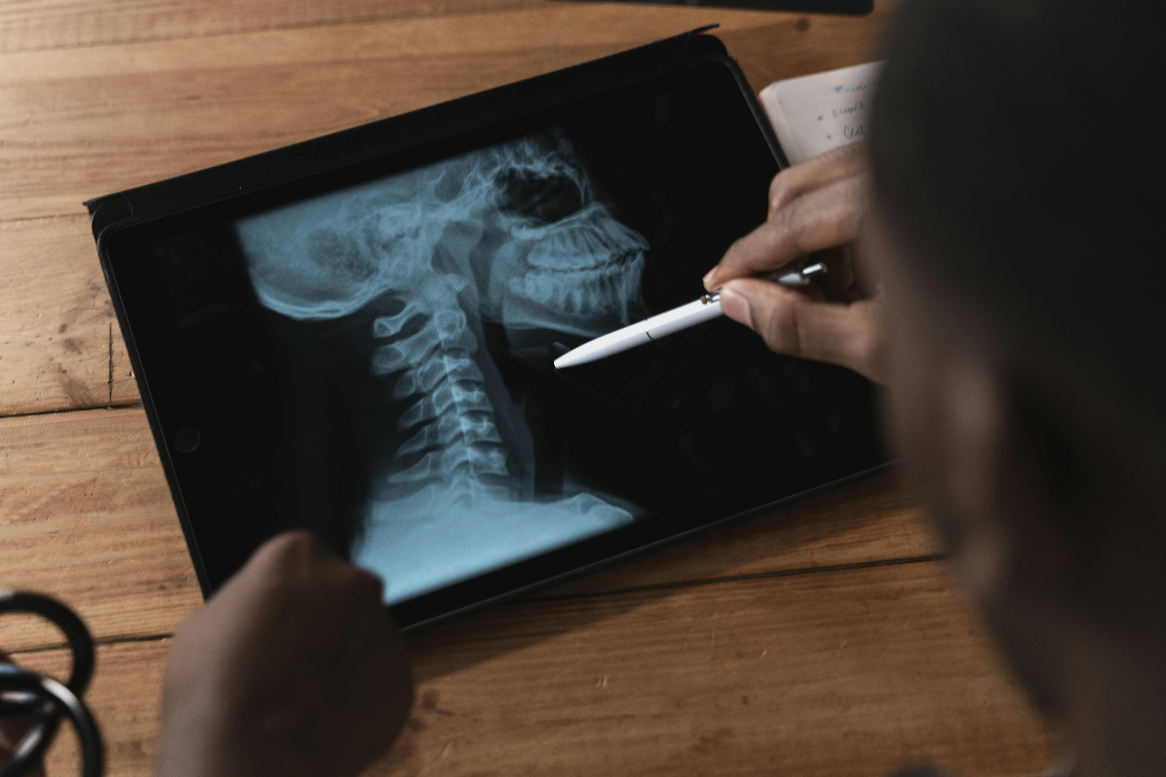Non-Surgical Spine Care